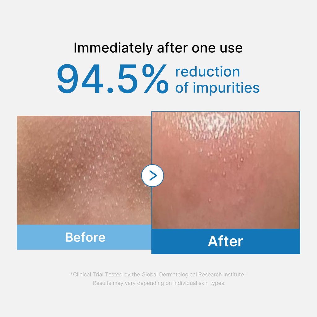 [GIFT] Zero Pore Blackhead Deep Cleansing Oil