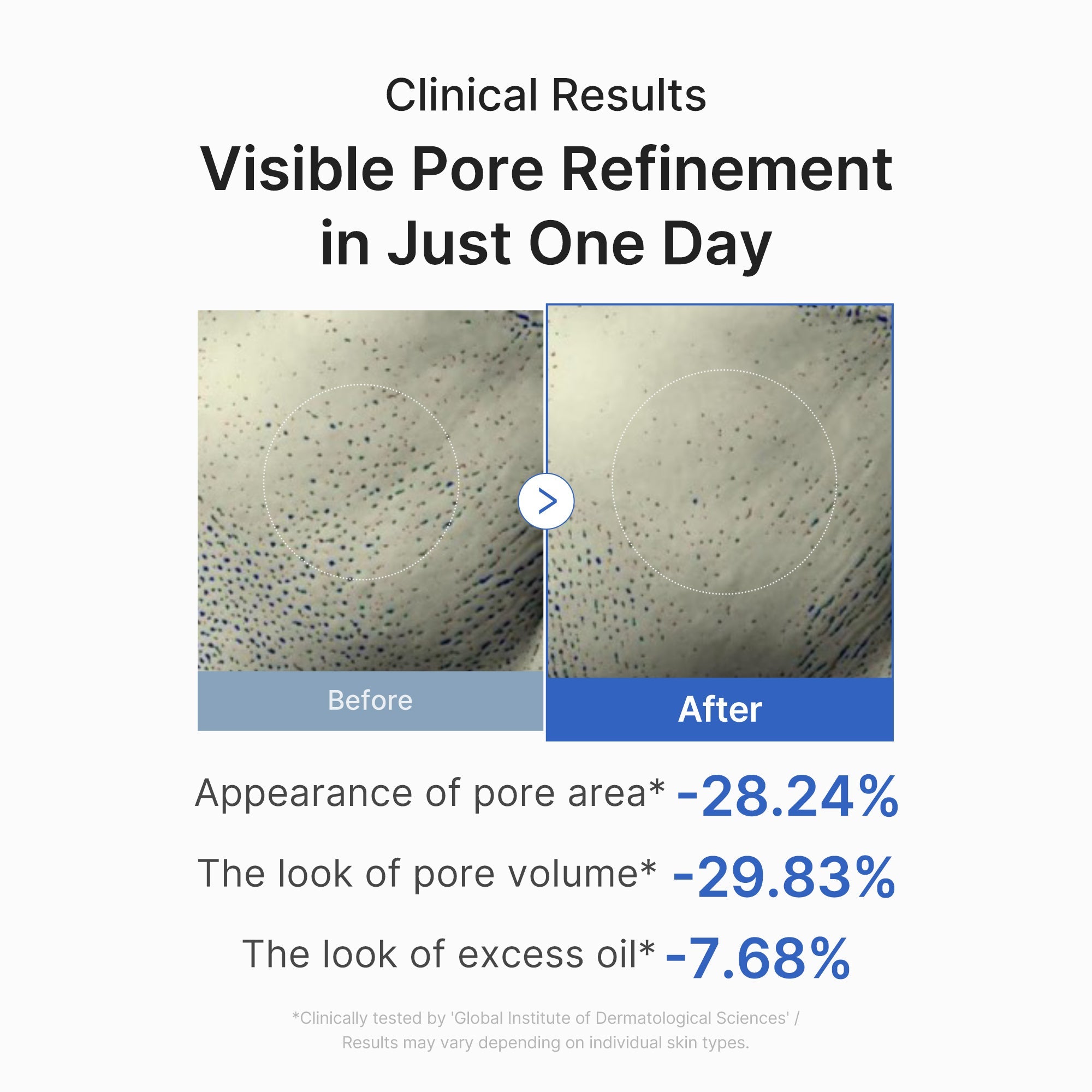 [Subscr.] Zero Pore One-day Peptide Serum