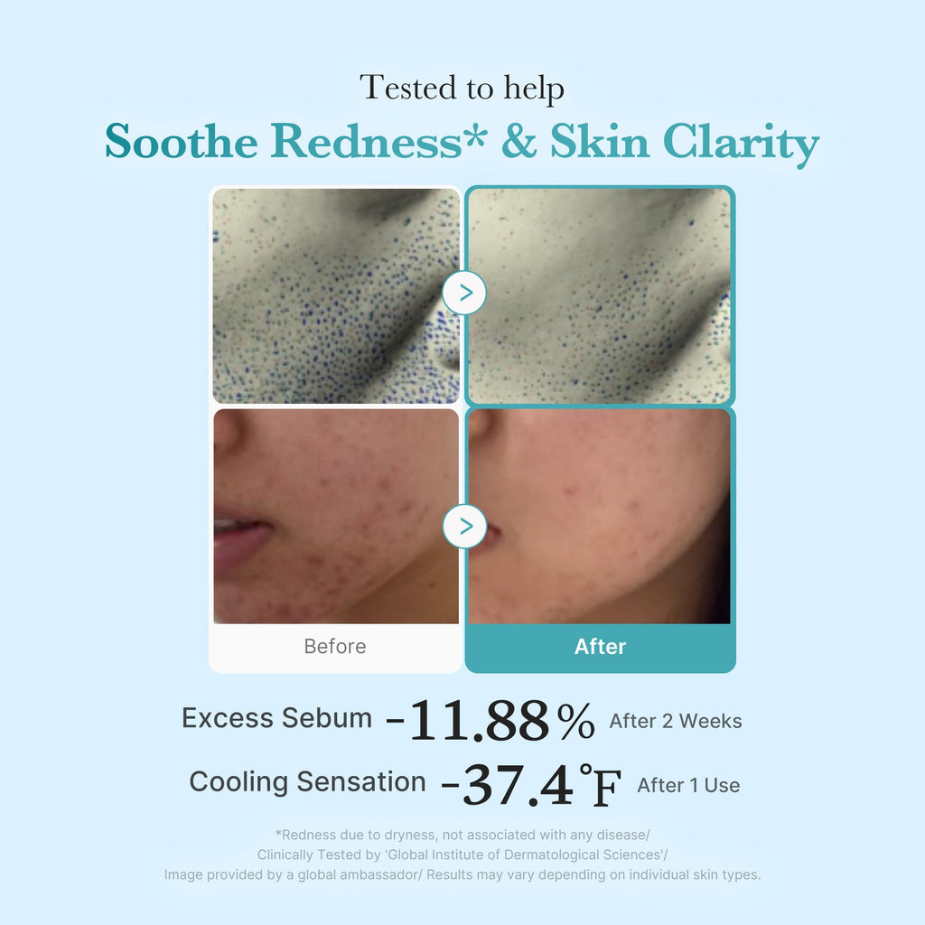 Azelaic Acid Niacinamide Clarifying Toner