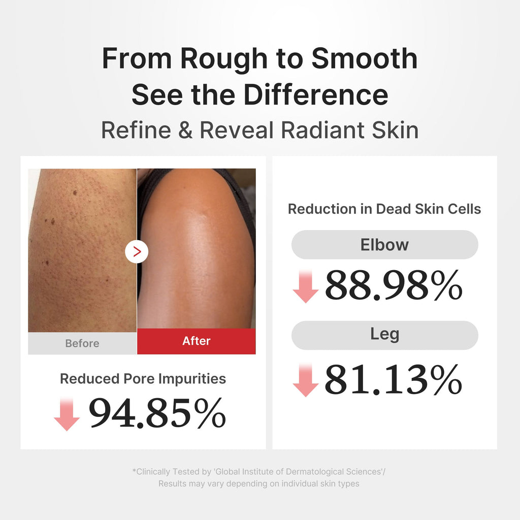 [GIFT] Hypochlorous Acid Rice Body Peel Shot