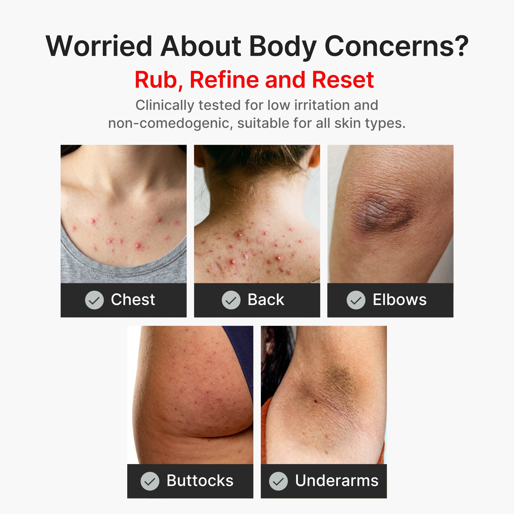 Kojic Acid Turmeric Body Peel Shot