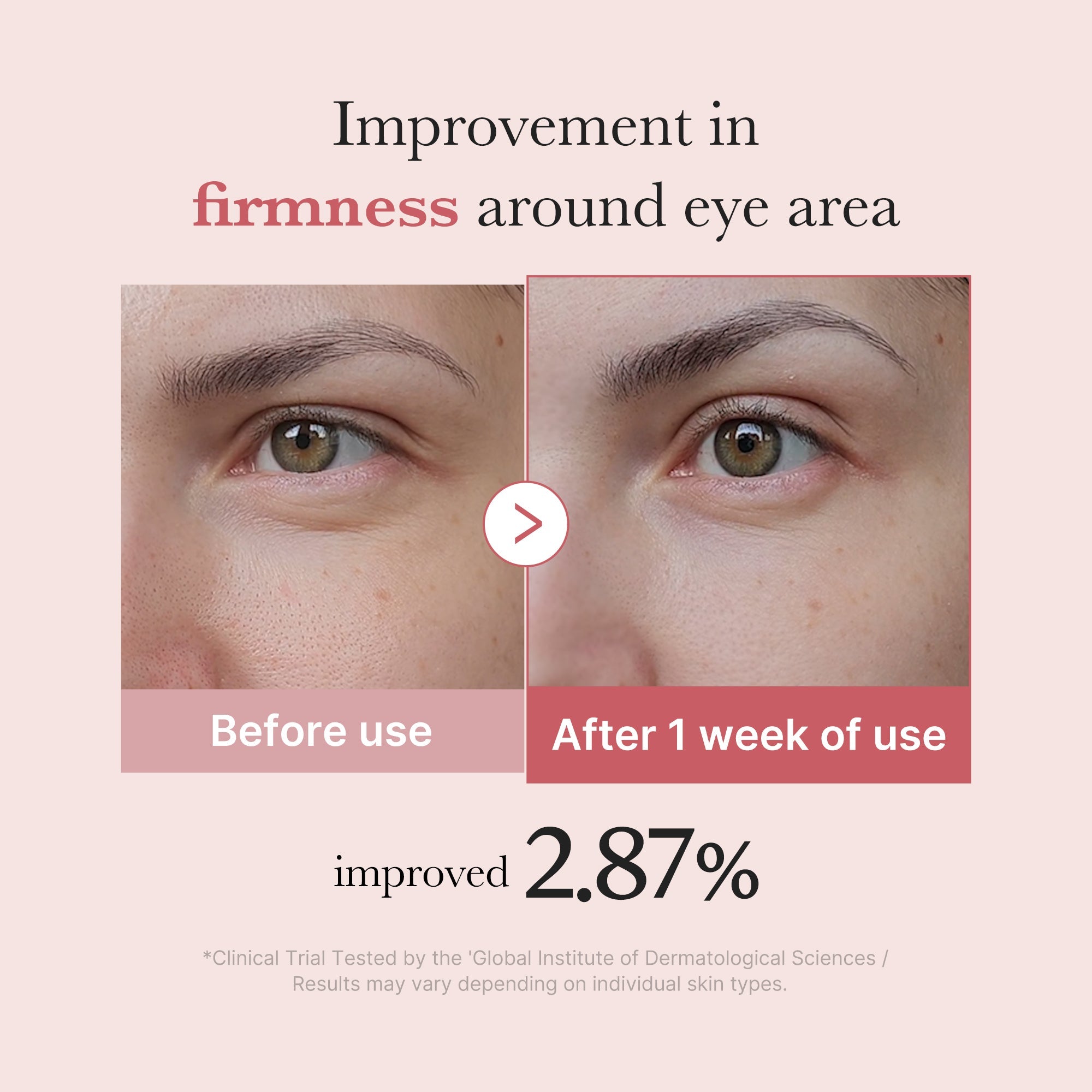 [GIFT] PDRN Pink Peptide Eye Cream